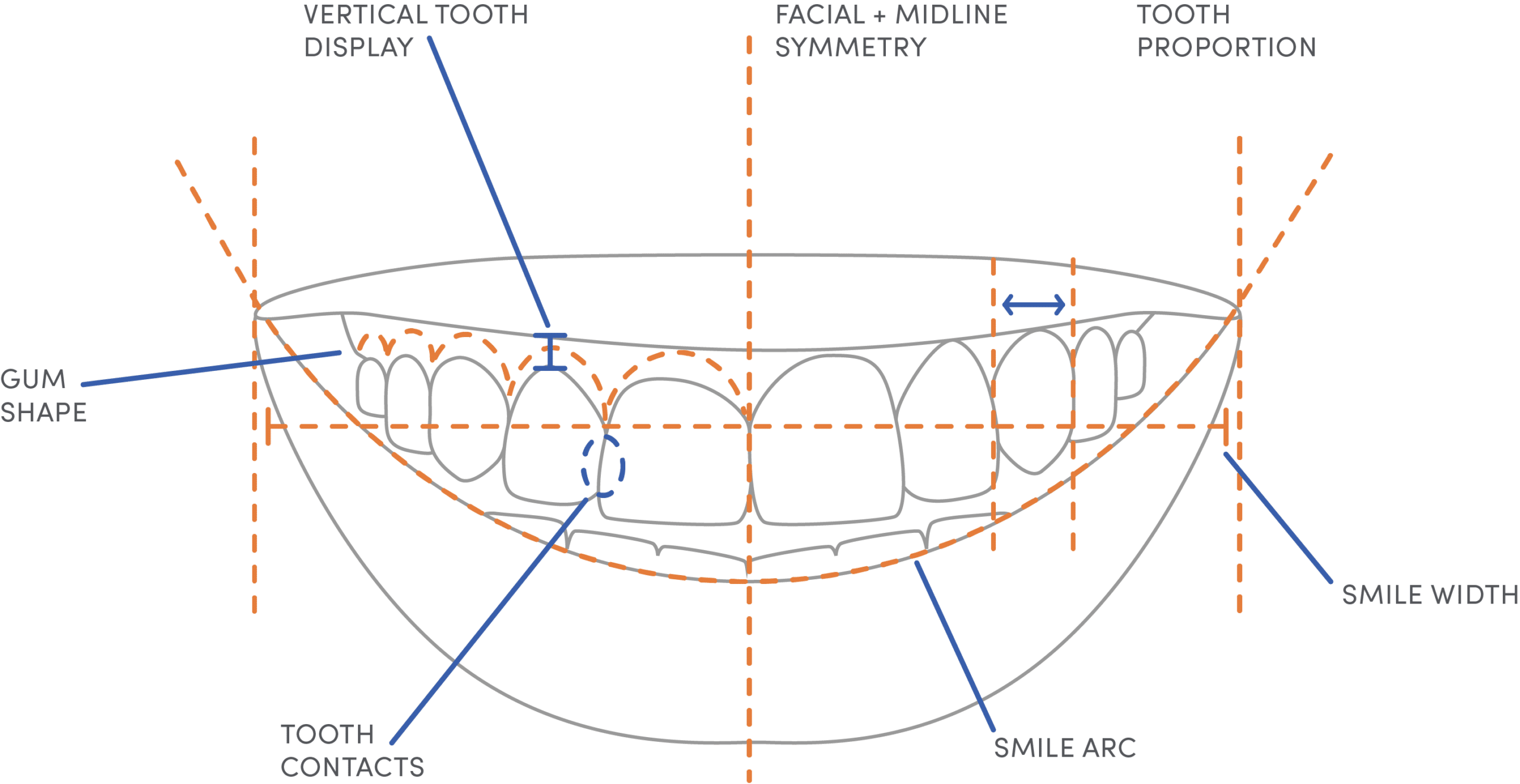 The jfo smile graphic_ss drawing Orthodontic smile design diagram showing tooth proportions, symmetry, gum shape, smile arc, and smile width labeled with lines and arrows.